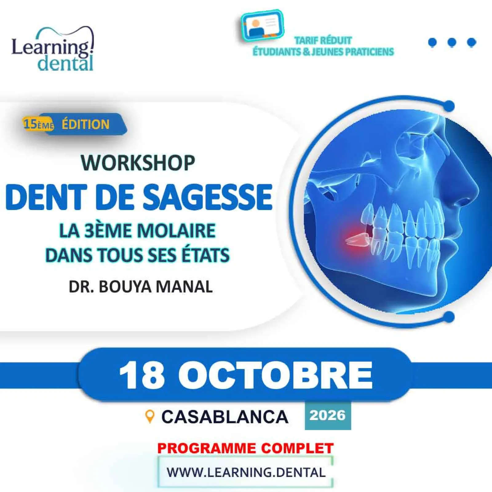 Formation dent de sagesse : la 3e molaire — Dr Manal Bouya