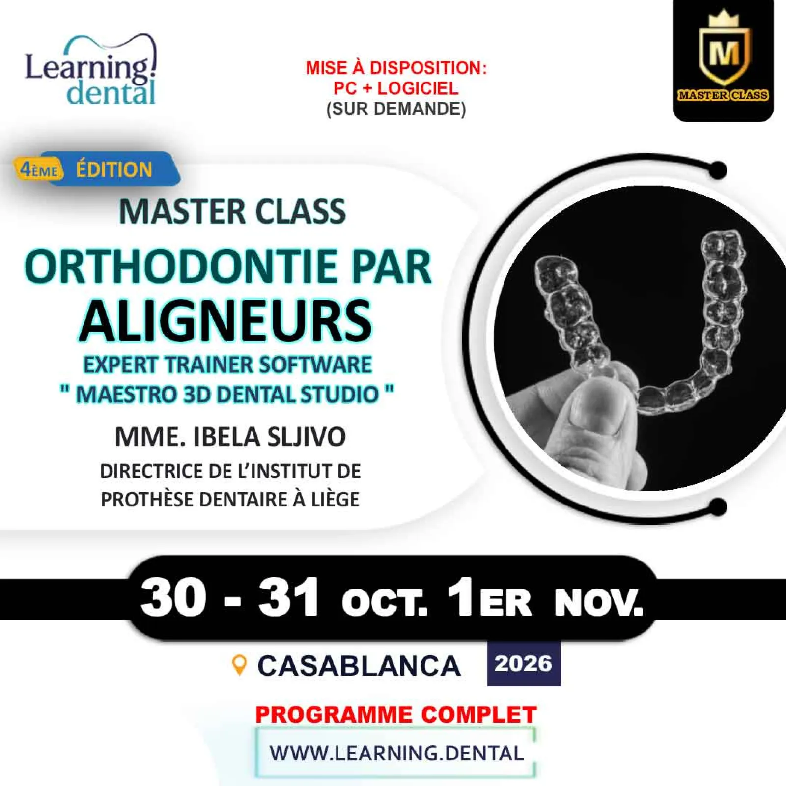 Orthodontie par aligneurs « home made » — conception et fabrication au cabinet