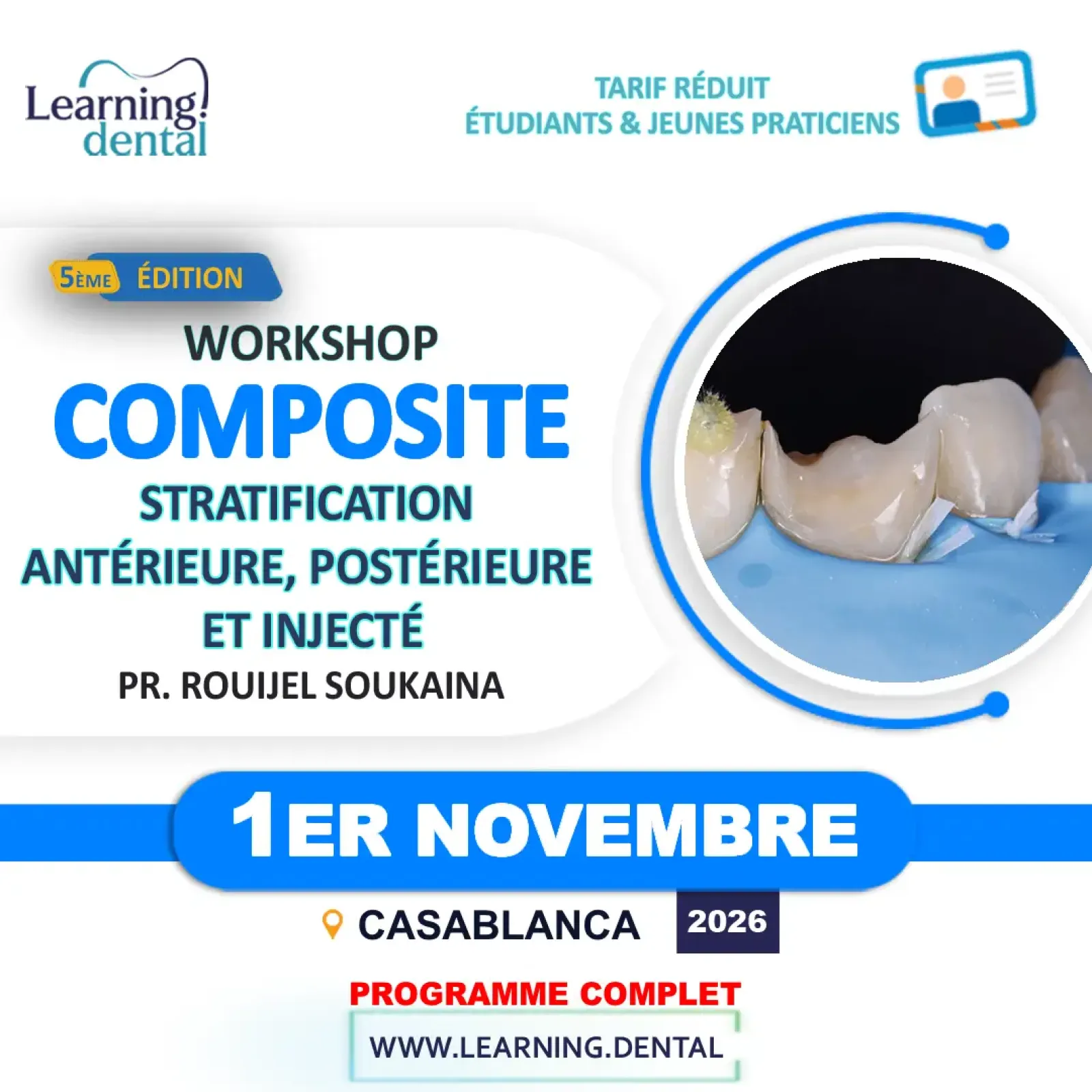 Workshop stratification aux composites — Pr Soukaina Rouijel