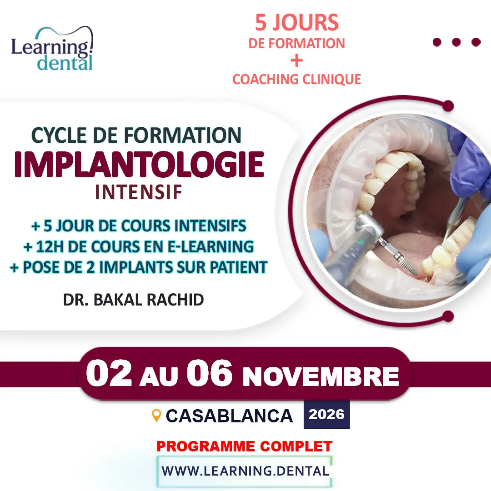 Cycle de formation en implantologie intensif — Dr Rachid Bakal