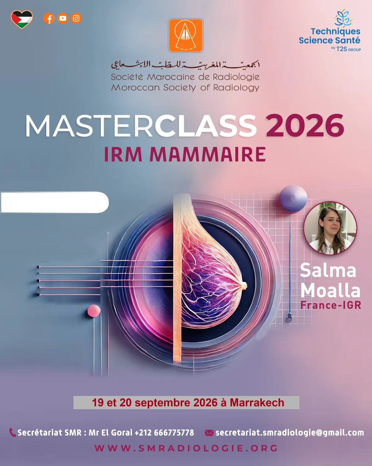 MasterClass 2026 IRM Mammaire — Société Marocaine de Radiologie