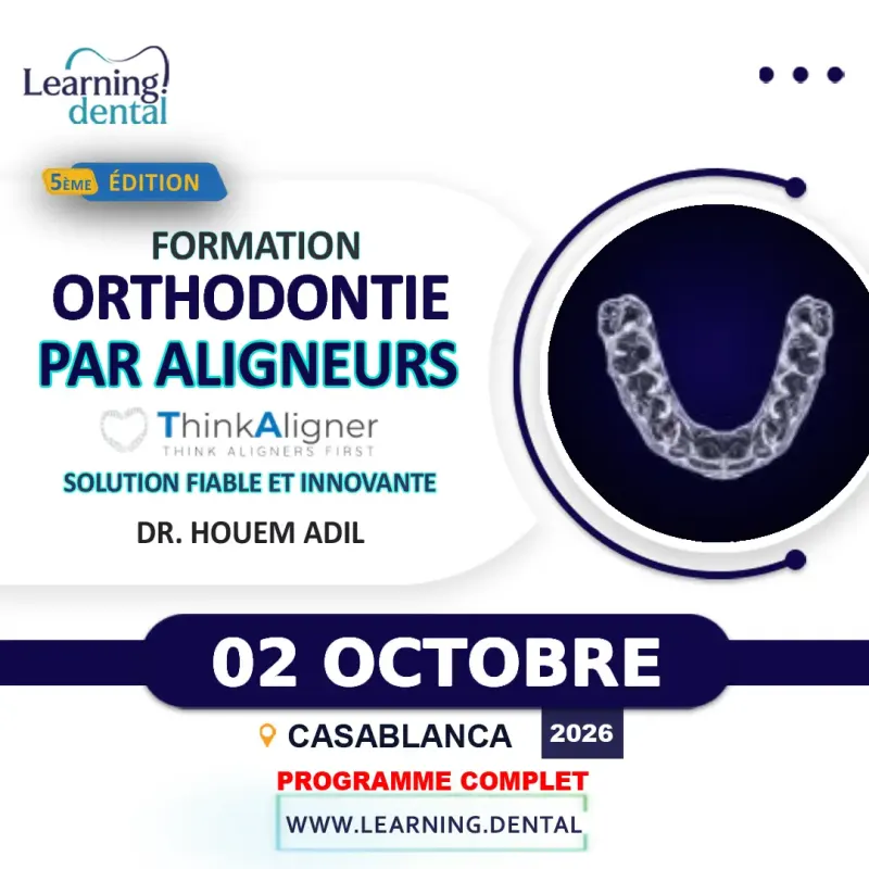 Orthodontie par aligneurs : Thinkaligner — Dr Adil Houem