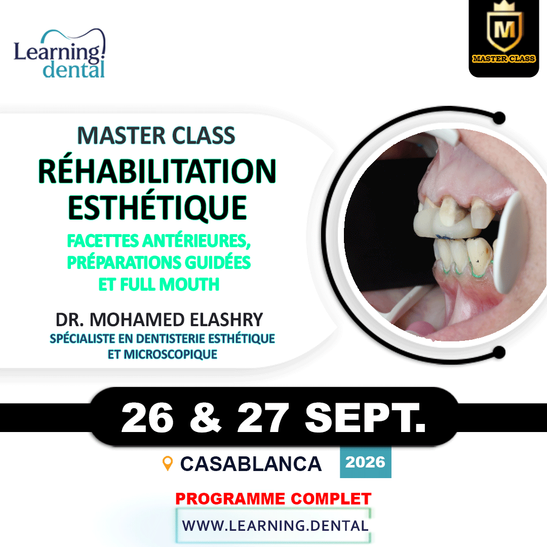 Master Class en réhabilitation esthétique dentaire — Dr Mohamed Elashry